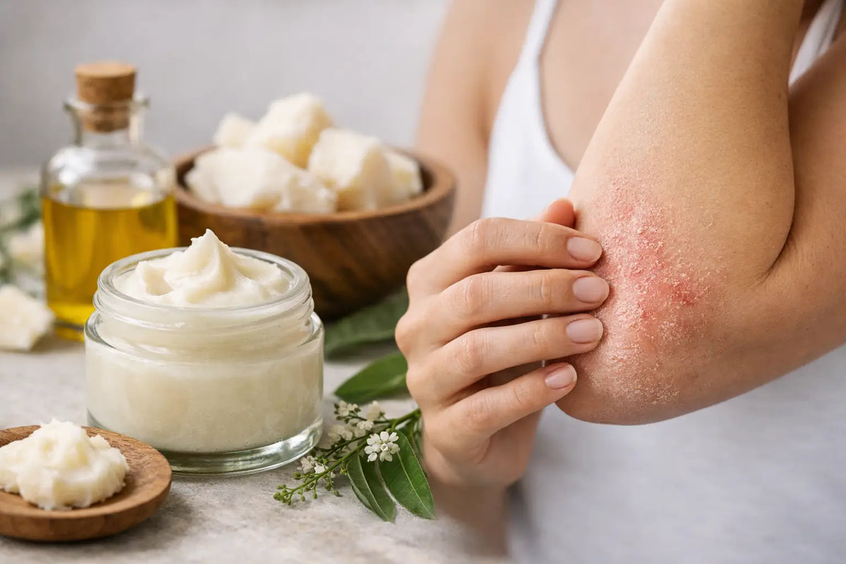 Is Tallow Good for Eczema? What Skin Needs
